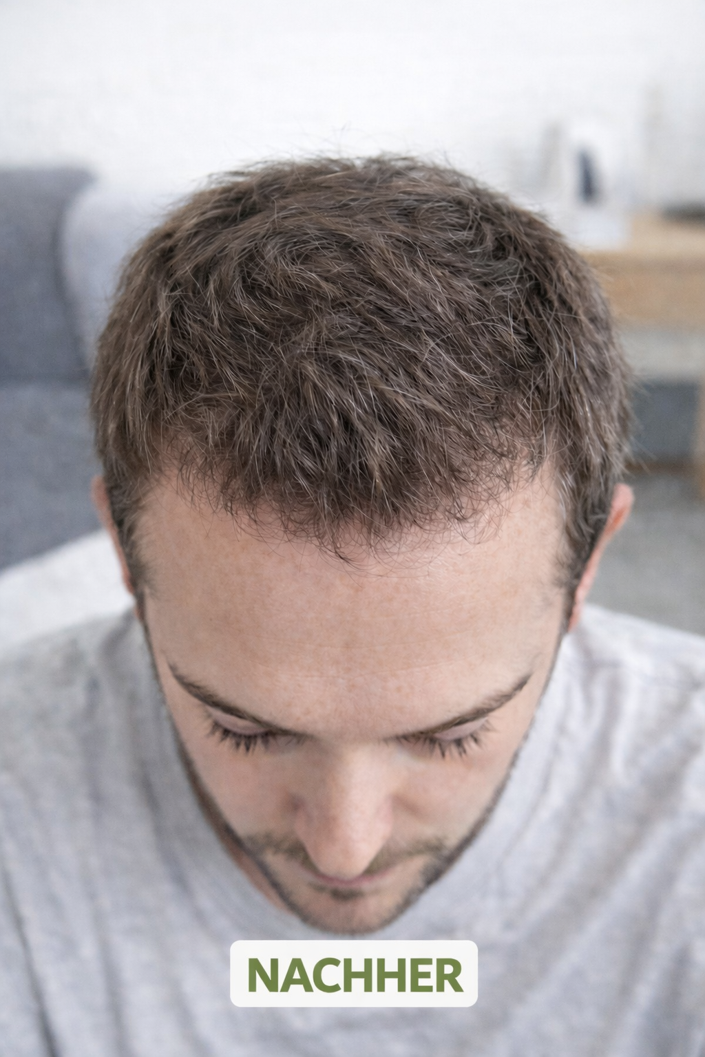 "Herbivance" Rosmarin-Haaraktivator