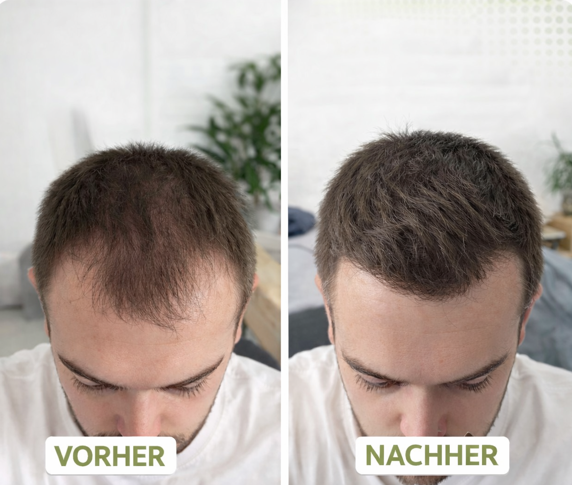 "Herbivance" Rosmarin-Haaraktivator