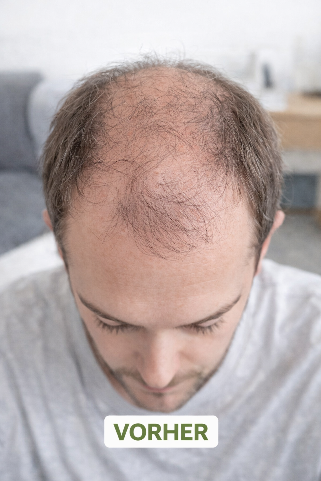 "Herbivance" Rosmarin-Haaraktivator