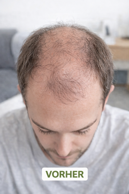 "Herbivance" Rosmarin-Haaraktivator