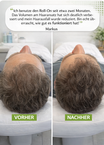 "Herbivance" Rosmarin-Haaraktivator